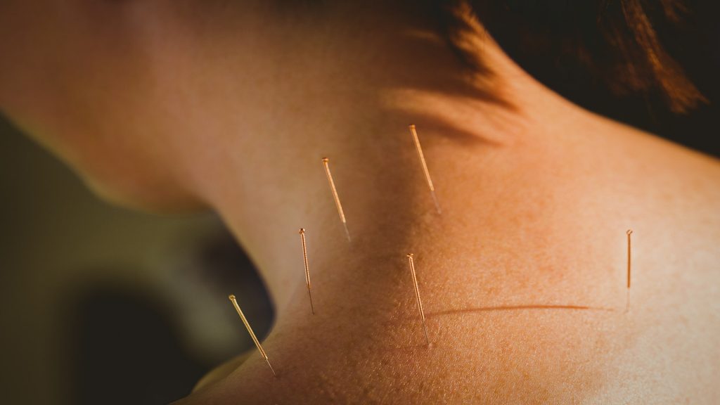 Main Line Acupuncture